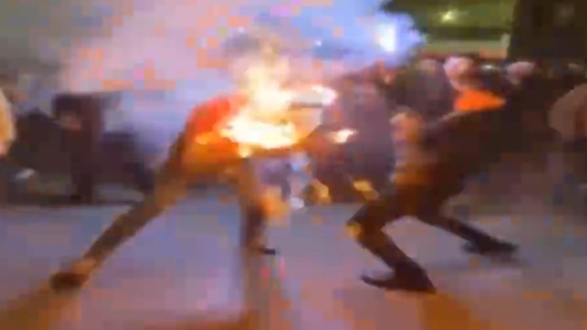 Konya’da asker uğurlaması faciaya döndü: Yüzünü yaktılar