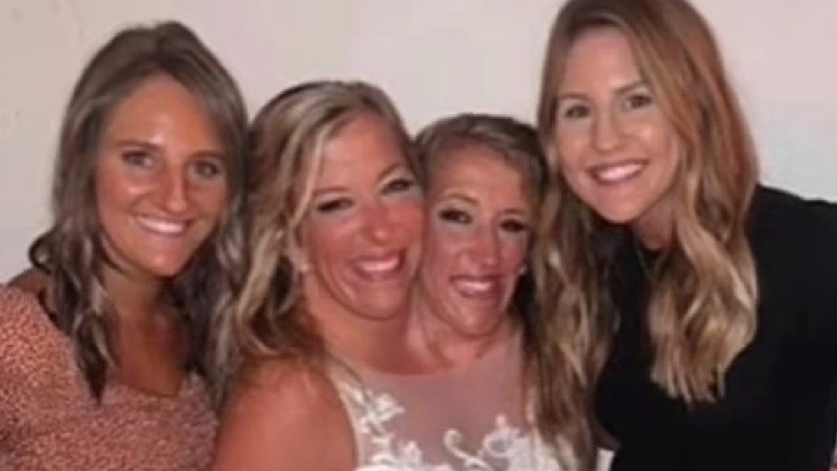 ABD’nin yapışık ikizlerinden birisi evlendi! İşte o anlar…