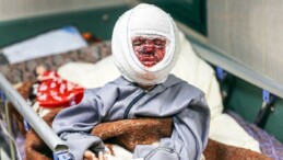 İsrail’in saldırılarında yaralanan 4 yaşındaki Seca’nın tedavisi hastane baskınında yarım kaldı
