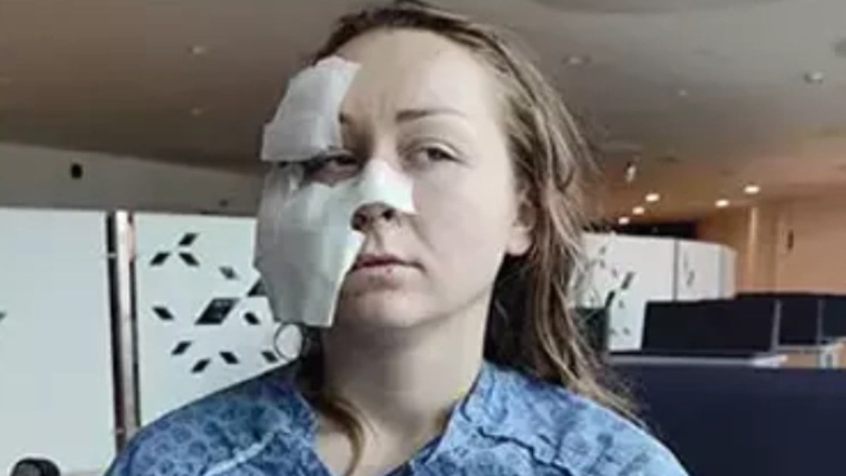 İstanbul’da boşanmak isteyen eşinin yüzünü falçatayla kesti: Mahkeme kararını verdi