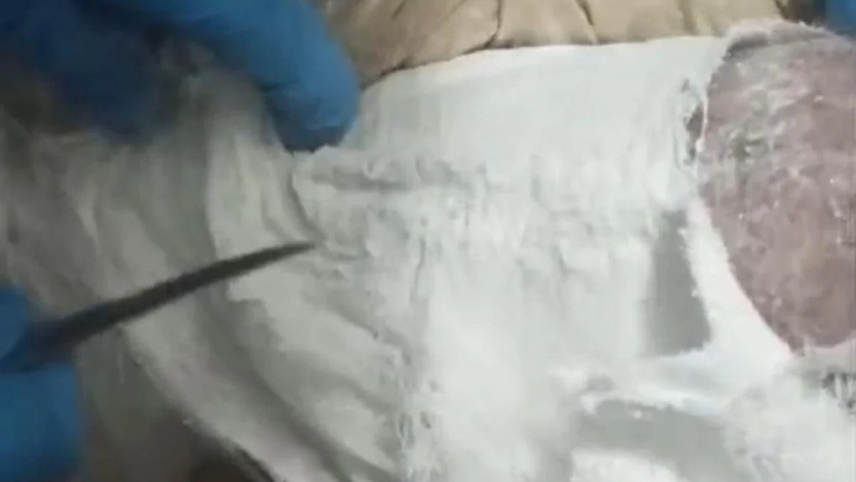 Muş’ta otobüsteki yolcunun ayağındaki alçıdan uyuşturucu çıktı