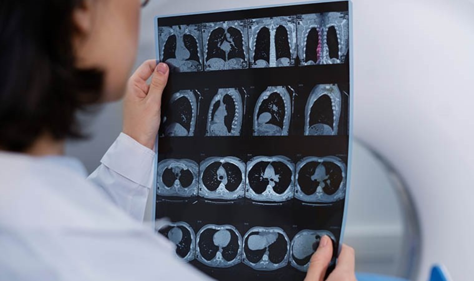 Bilim insanlarından çığır açacak keşif: Alzheimer riskini düşürecek gen bulundu!