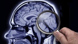 Demans ve Alzheimer: Belirtileri nedir, hangi tedaviler uygulanıyor?