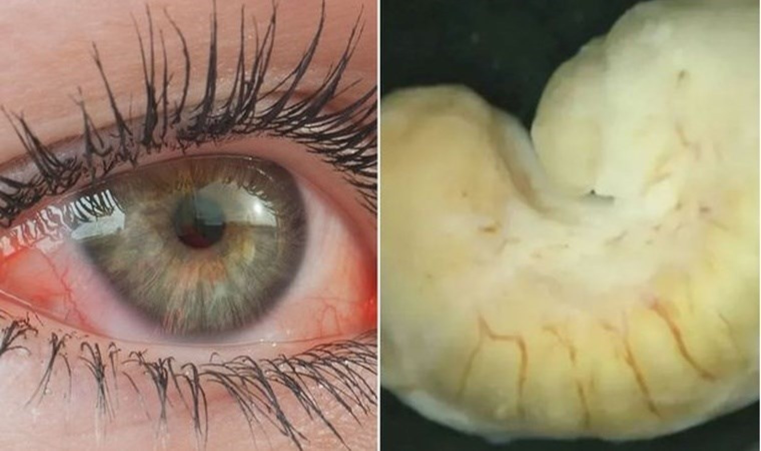 Gözünün içinde tespit edildi: Tabipler dehşete düştü!