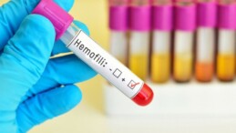 Hemofili nedir? Hemofili belirtileri neler?