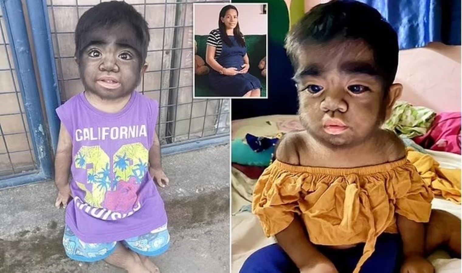 Milyarda bir görülüyor: Dünya’nın en kıllı bebeği iki yaşında!