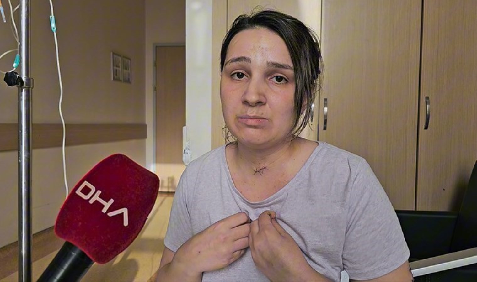 ‘Mucize kadın’ yaşadığı dehşeti anlattı: ‘Başımda ölmemi bekledi’