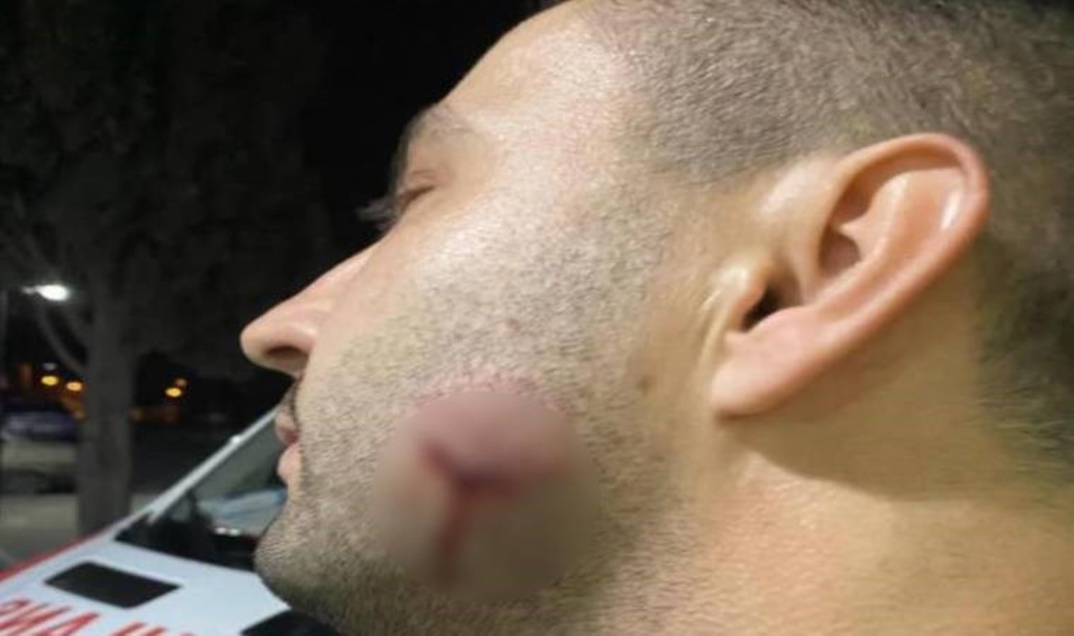 Sıhhat çalışanlarına saldıran uzman çavuş açığa alındı