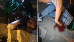 Üsküdar’da motokuryeye atak: 5 yerinden bıçaklandı!