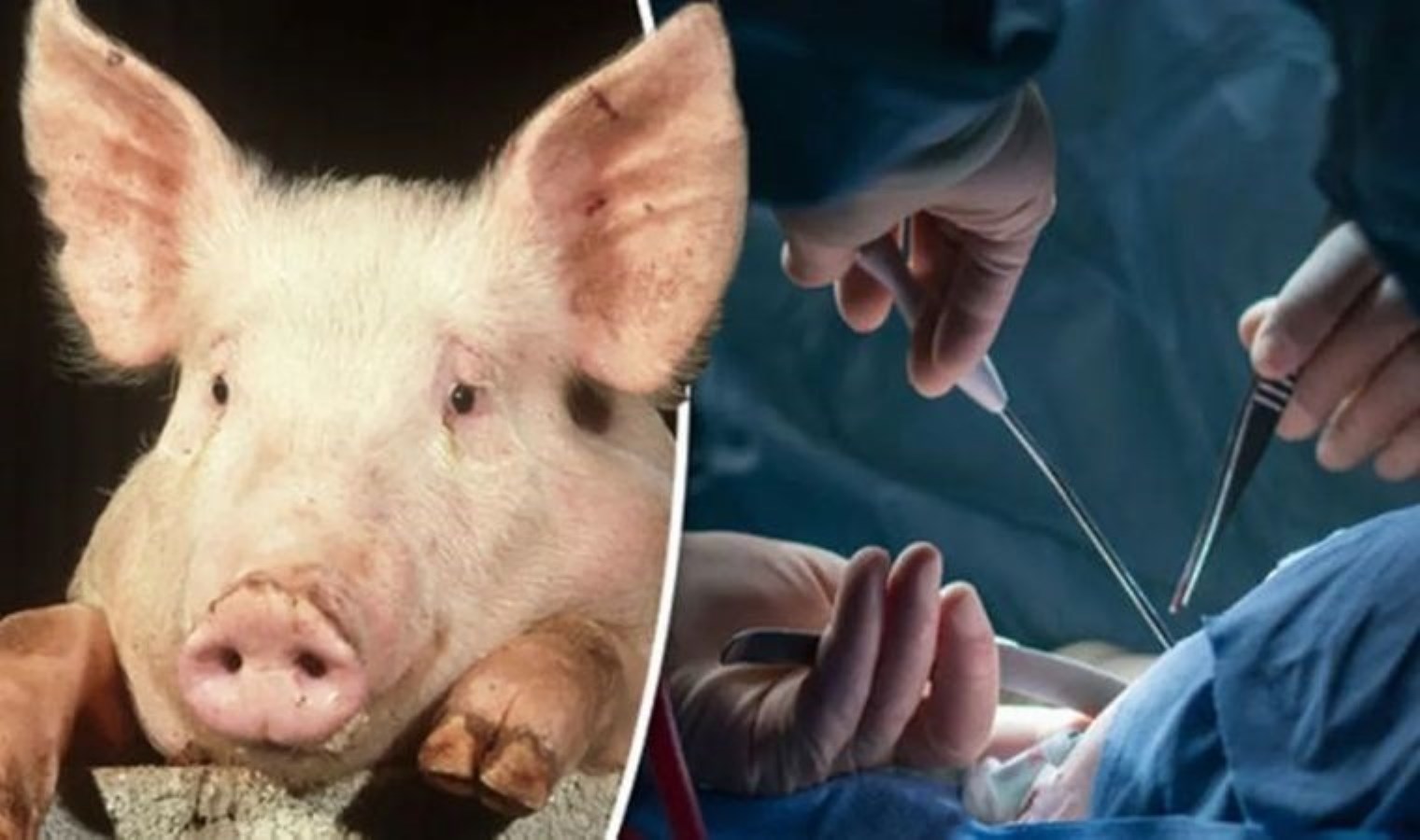 ABD’de, domuz böbreği nakledilen birinci hasta hayatını kaybetti