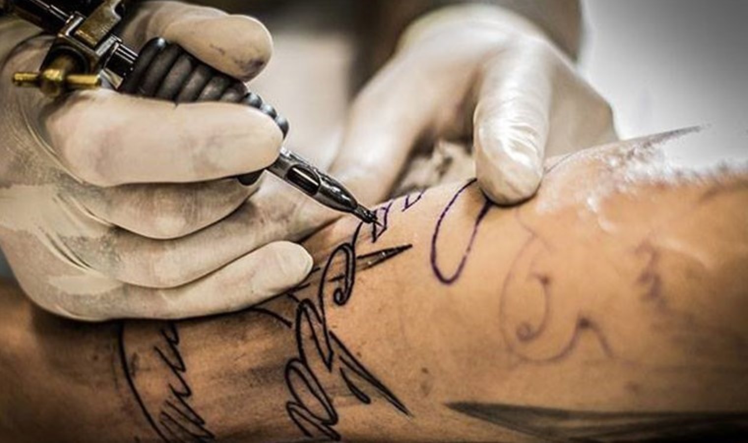 Araştırma: Son 5 yılda 1 milyondan fazla dövme sildirme süreci uygulandı