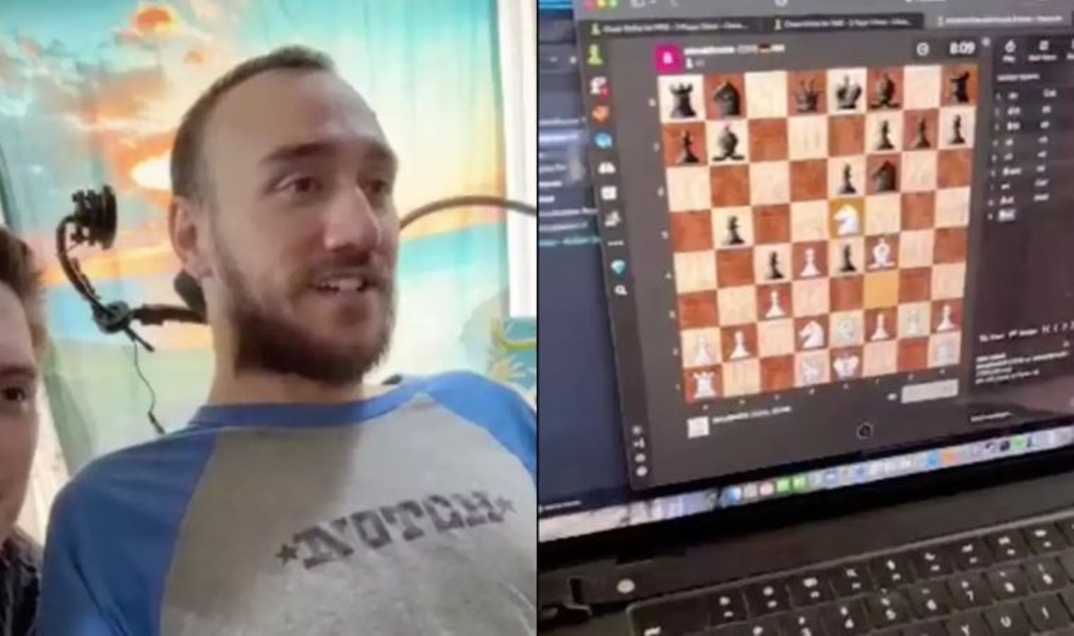 Elon Musk’ın beyin çipi, birinci kere arıza yaptı