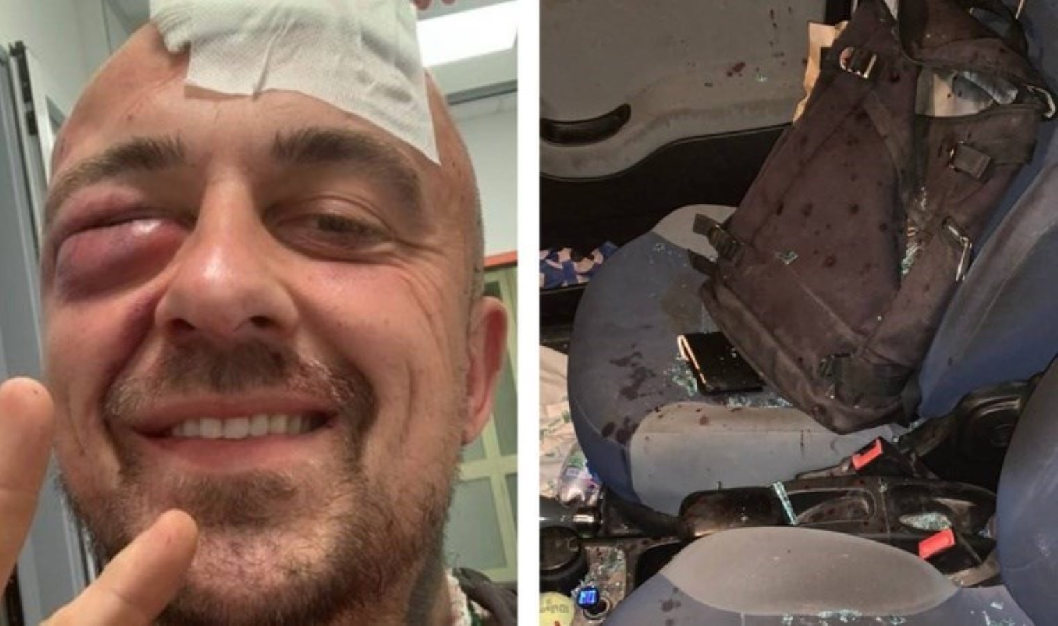 Filistin destekçisi İtalyan şef hücuma uğradı