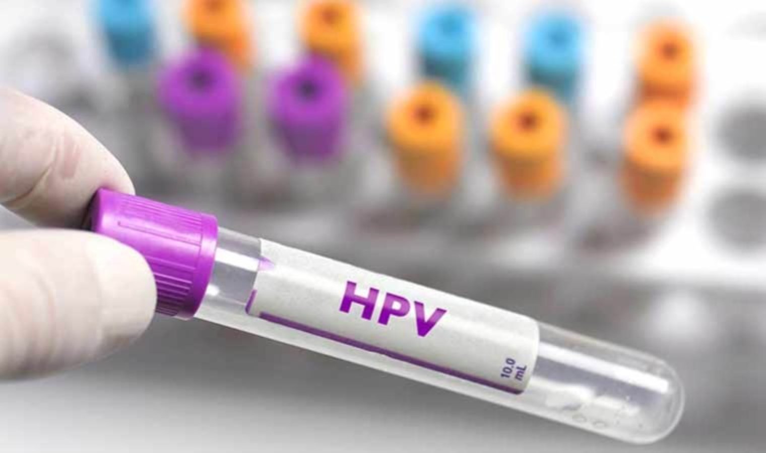 İBB ücretsiz HPV aşısı başvurusu ne vakit başlayacak? İBB ücretsiz HPV aşısı başvurusu nasıl yapılır?