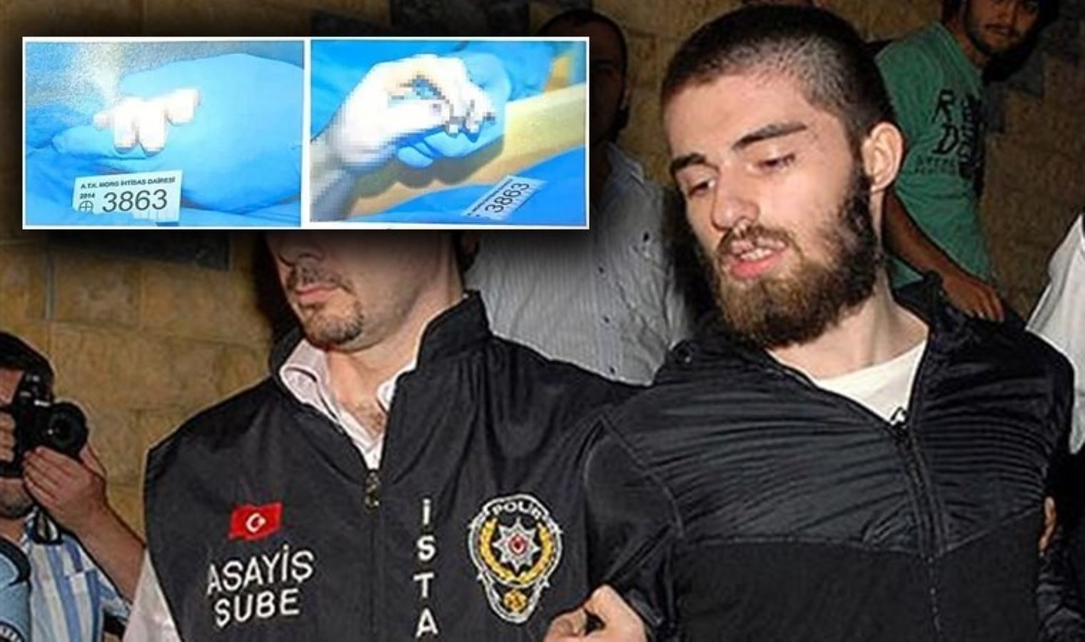 Katil Cem Garipoğlu’nun elindeki mor lekelerin sırrı ortaya çıktı !!!