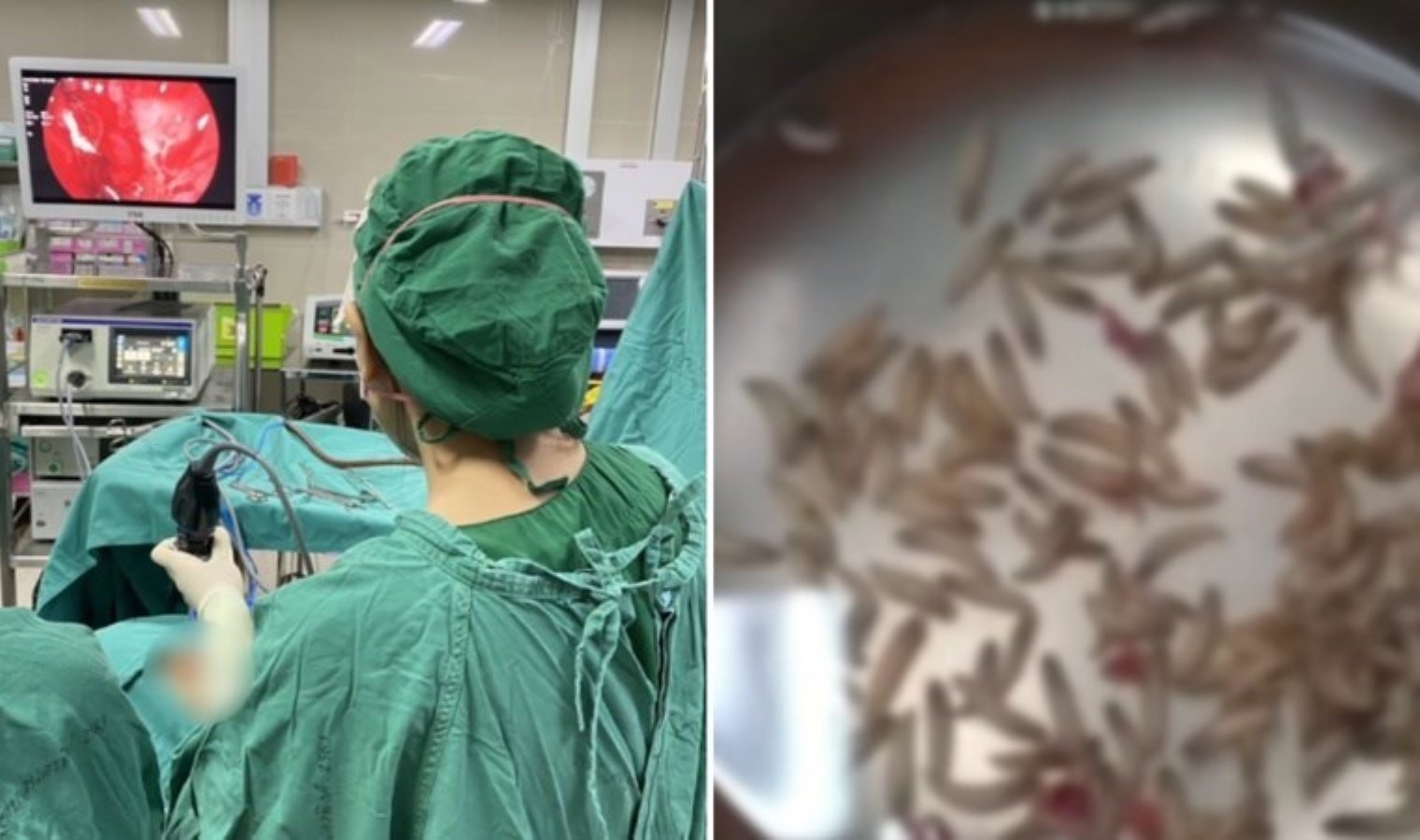 Kıl hissesi vefattan döndü: Burun tıkanıklığından şikayet ederek hastaneye gitti!