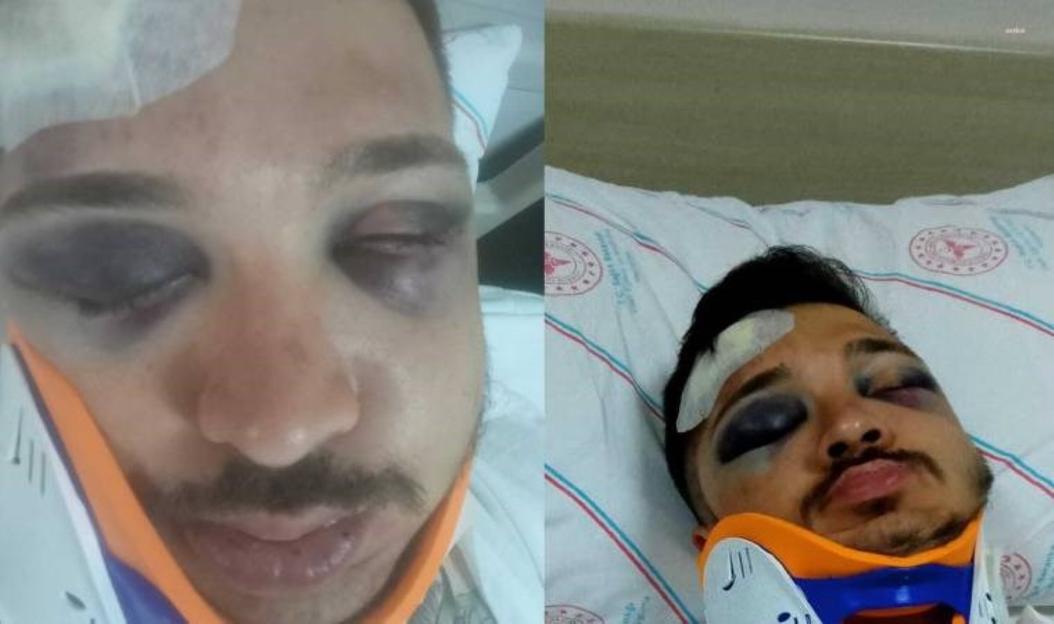 Uşak’ta sokak ortasında bir genç tanımadığı şahısların saldırısına uğradı