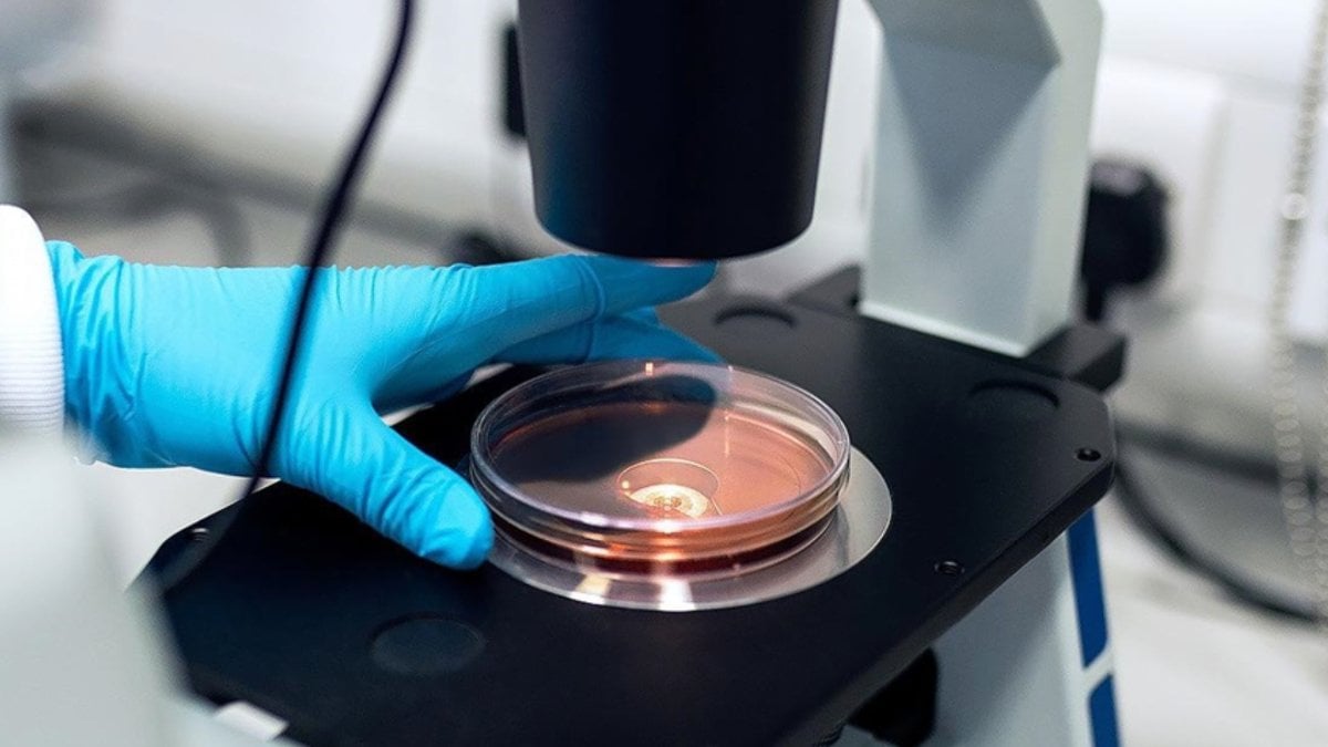 Japonya’da ‘et yiyen’ STSS bakterisi vaka sayısı yükseldi