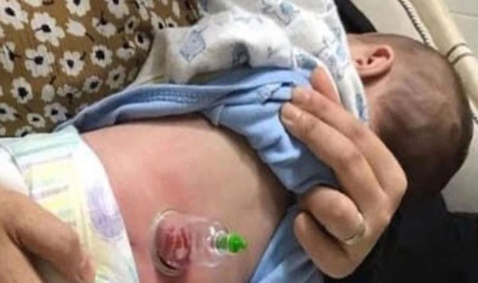 Başakşehir’de bebeklere hacamat skandalı! Bakanlık soruşturma başlattı