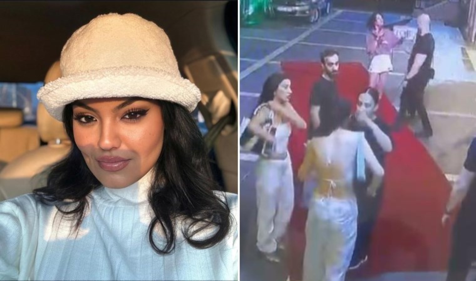 Eğlence mekanında ‘Kısmetse Olur’ yarışmacısına saldırı: Başına topuklu ayakkabıyla vuruldu, 12 dikiş atıldı