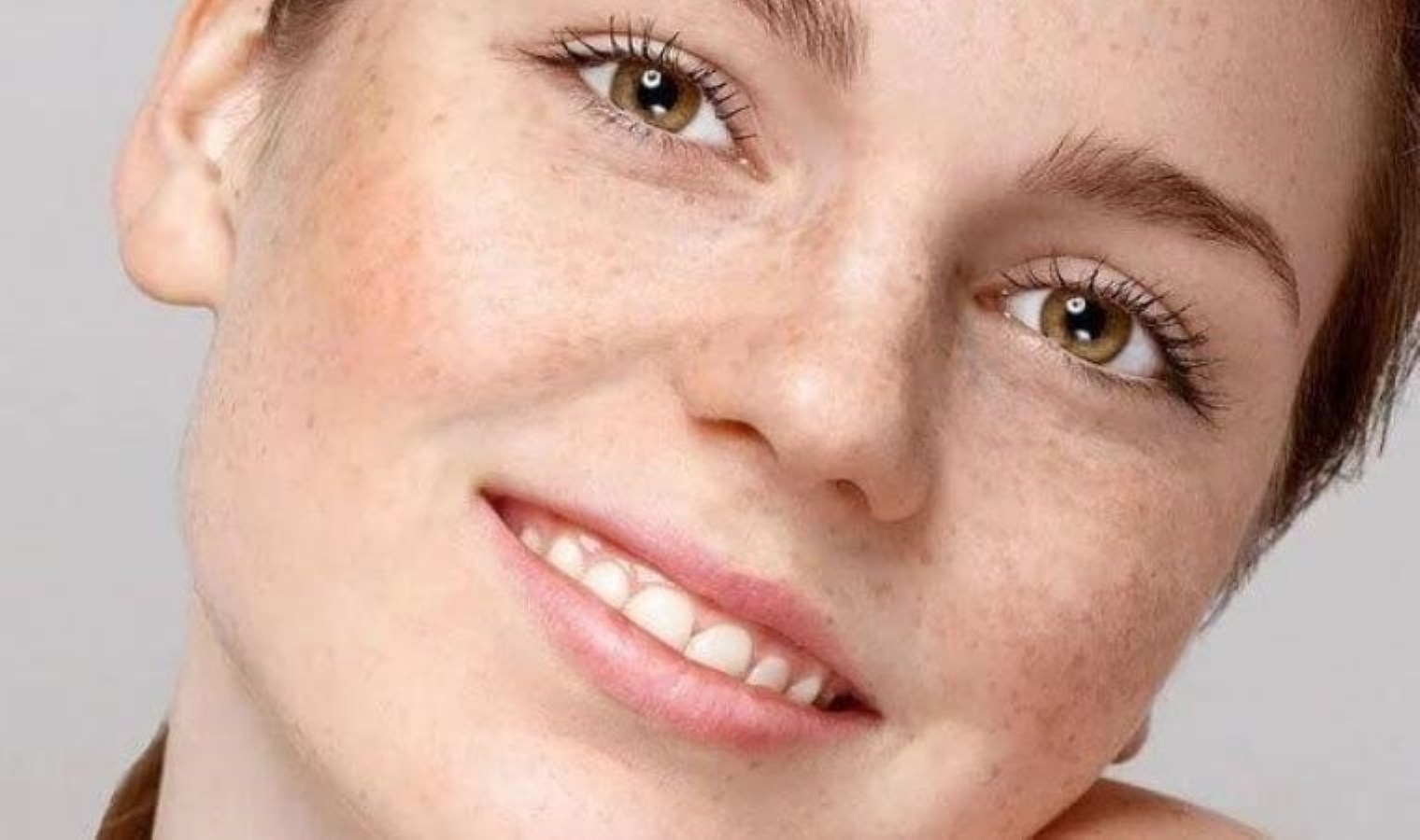 Çillerinizden rahatsız oluyorsanız bu teknikler size deva olacak: Çillerden kurtulmanın 5 doğal yolu