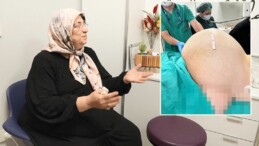 Doktorları bile şaşırttı: Fobisi yüzünden hastaneye gitmeyen kadının yumurtalıklarından 23 kiloluk kitle çıkarıldı