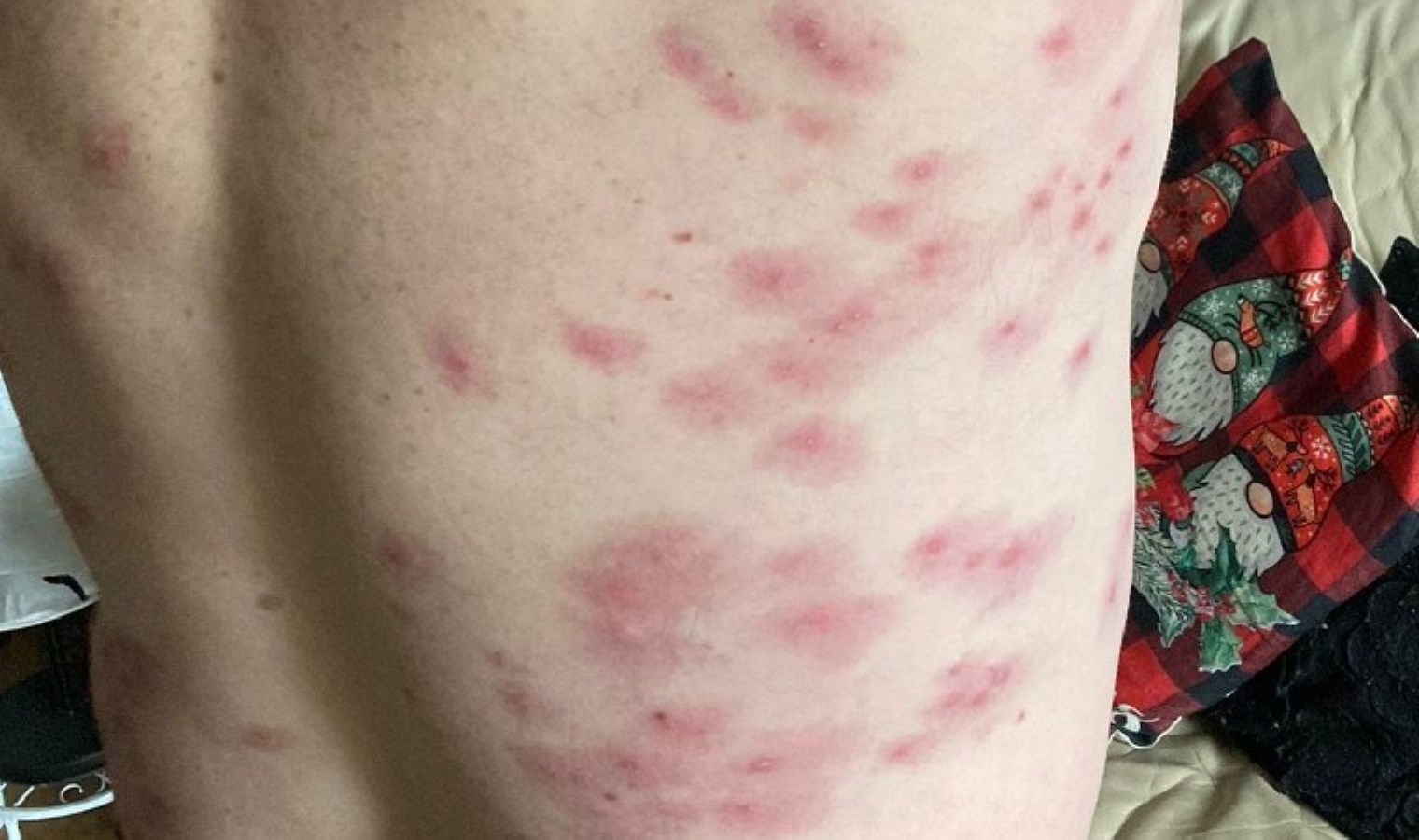 Eşek arısı sürüsü tarafından 240 kez sokuldu: ‘Bilincim gidip geliyordu…’