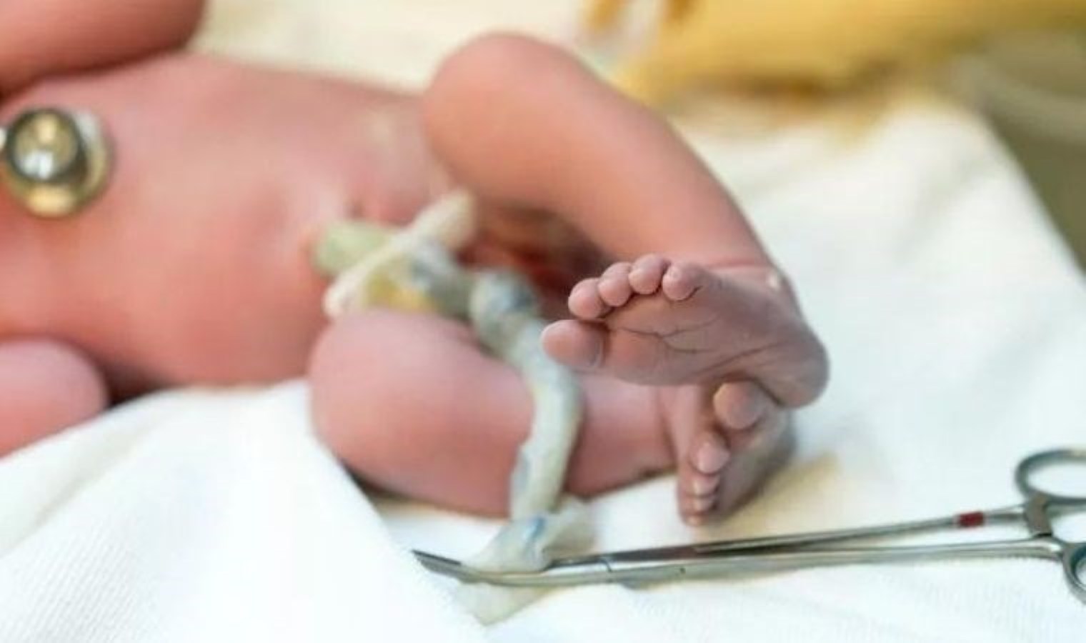 Göbek Kordonu Kanı ve Otizm Arasındaki Yeni Bağlantılar