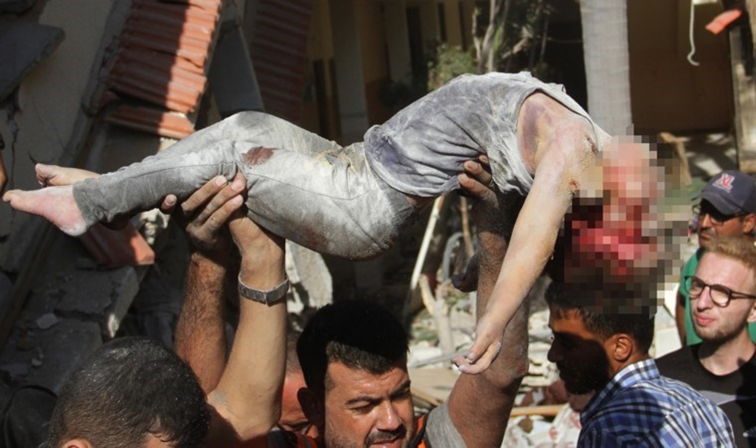 İsrail Saldırıları Sonrası Gazze’deki Acı Durum