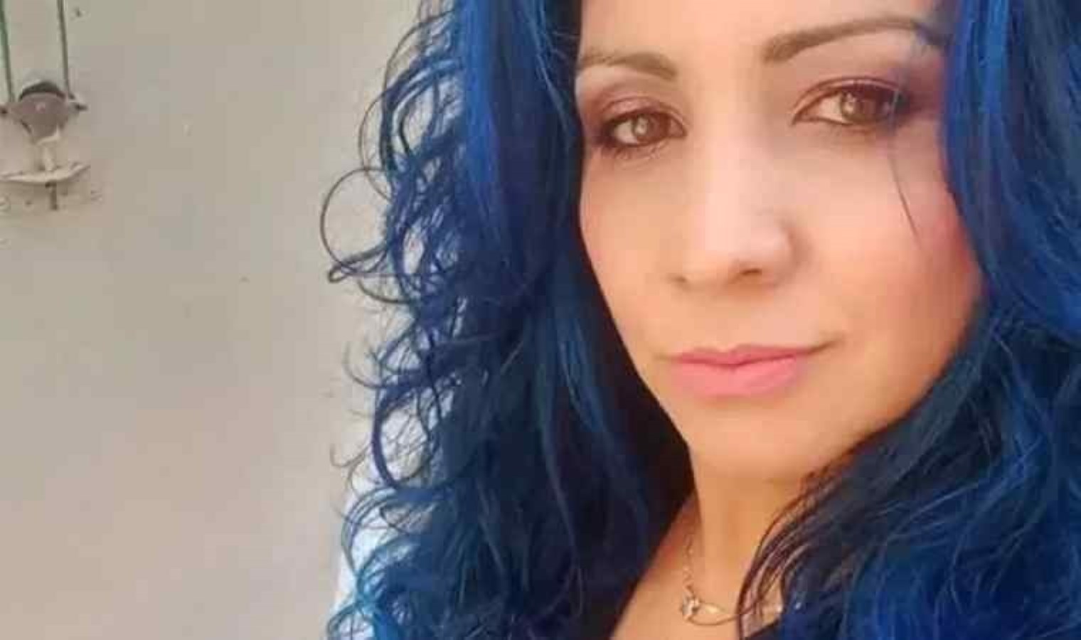 İstanbul’da Estetik Ameliyat Sonrası İspanyol Kadın Hayatını Kaybetti