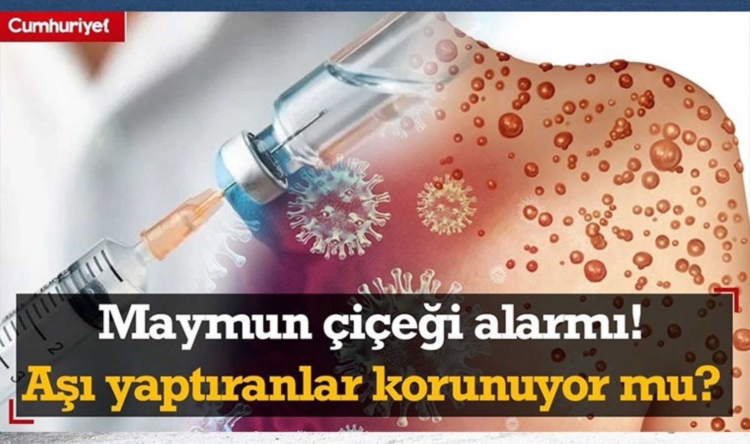 Maymun çiçeği alarmı! Çiçek aşısı yaptıranlar hastalıktan korunuyor mu?