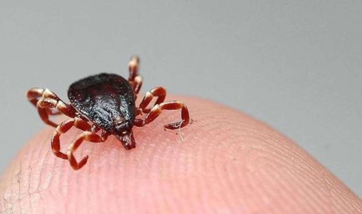 Tokat’ta Kene Vakası: KKKA Tanısı ve Tedavi Süreci