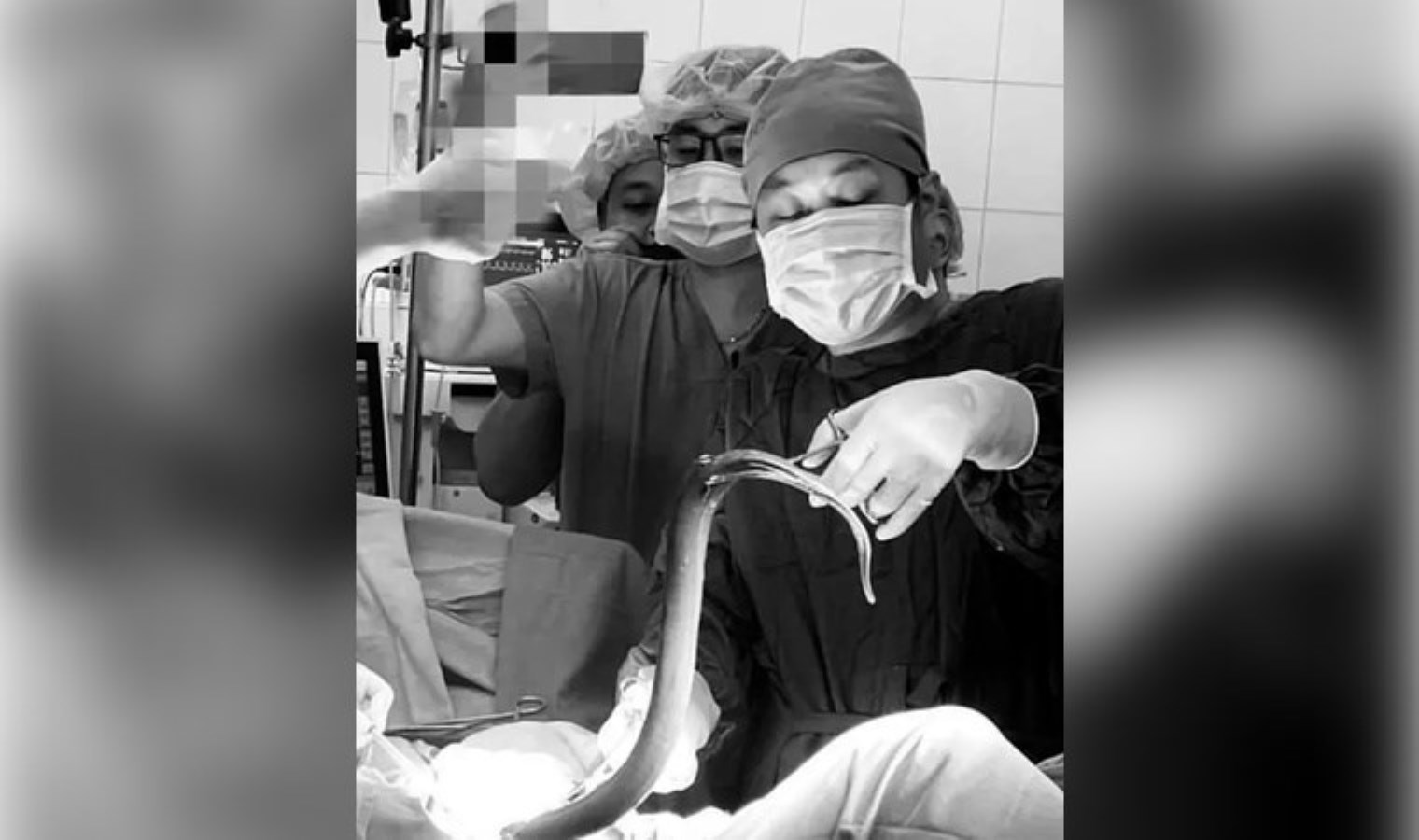 Vietnam’da Yılan Balığı Karnında Bulunan Adam