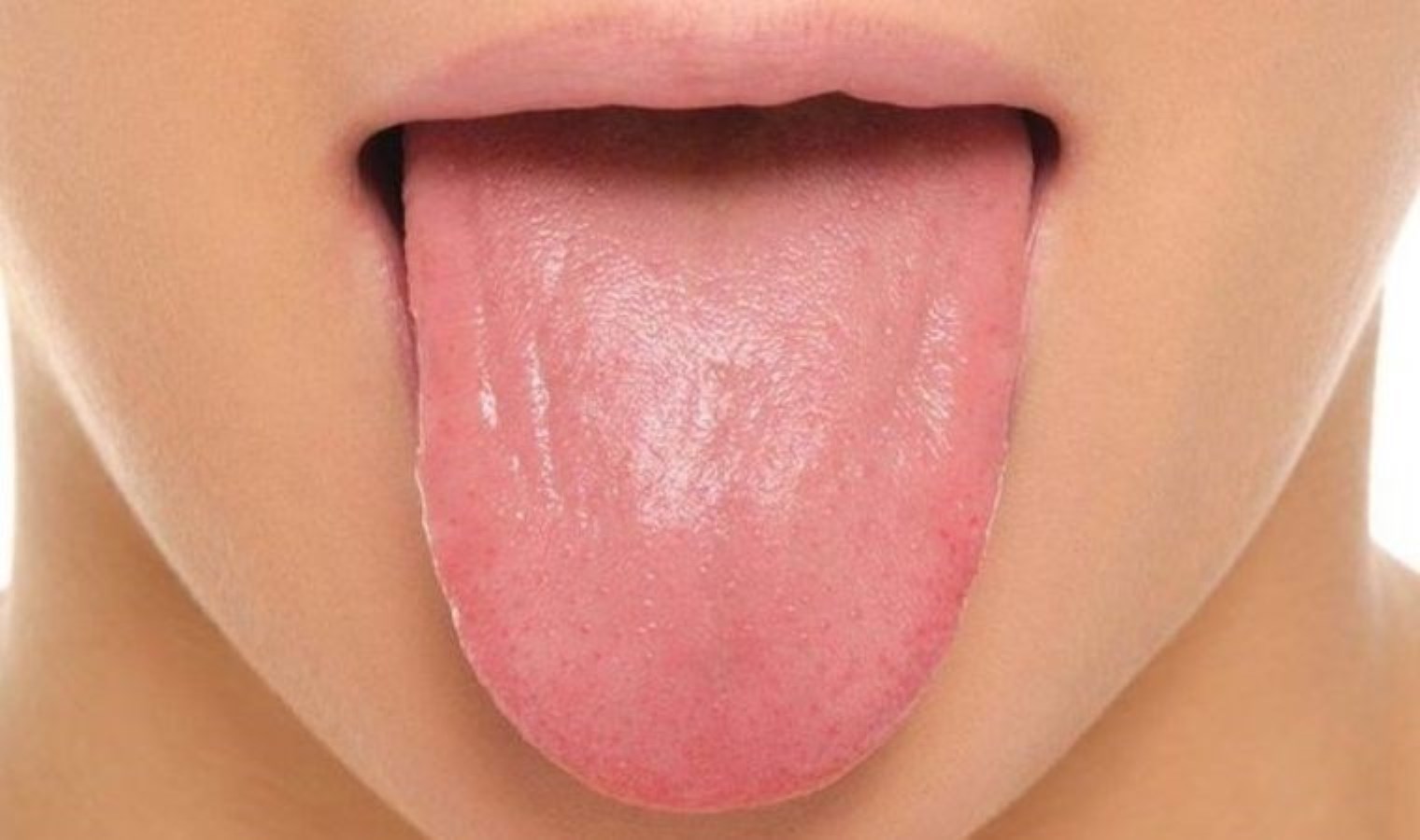 Dil renginiz birçok hastalığın habercisi olabilir