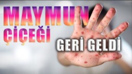 Maymun Çiçeği Virüsü ! GİZLENEN GERÇEK | Havadiskolik