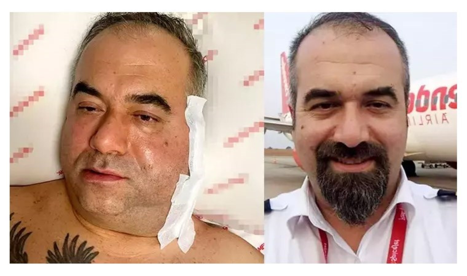 Pilotun ameliyatta ölümünde, ‘doktor ihmali’ iddiası