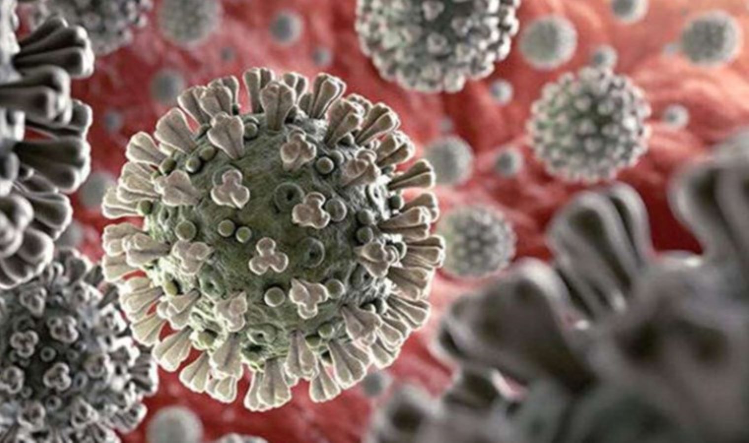 Almanya’da görüldü: Marburg virüsü nedir, belirtileri neler?