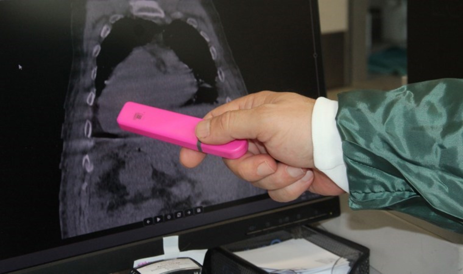 Türkiye’de bir hasta dünya tıp literatürüne girdi: ‘Giresun Sendromu’