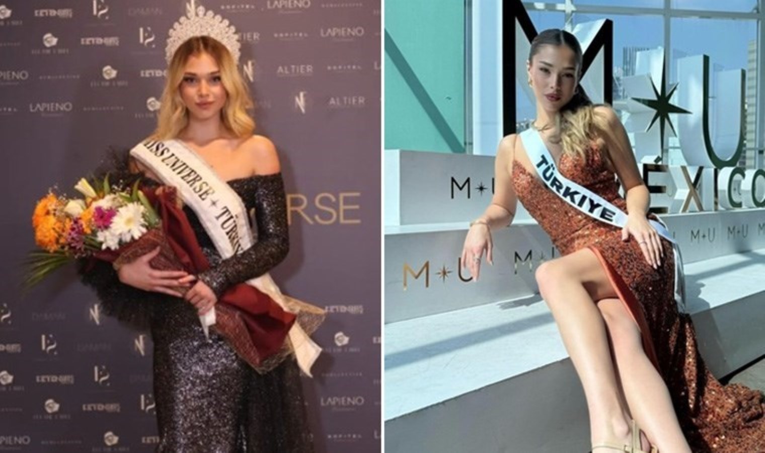 2024 Kainat Güzeli adayı Ayliz Duman ‘estetik’ iddialarına yanıt verdi