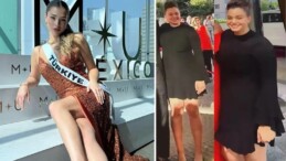 Miss Universe’de (Kainat Güzellik Yarışması) Türkiye’yi temsil etmişti: Eski halini paylaştı