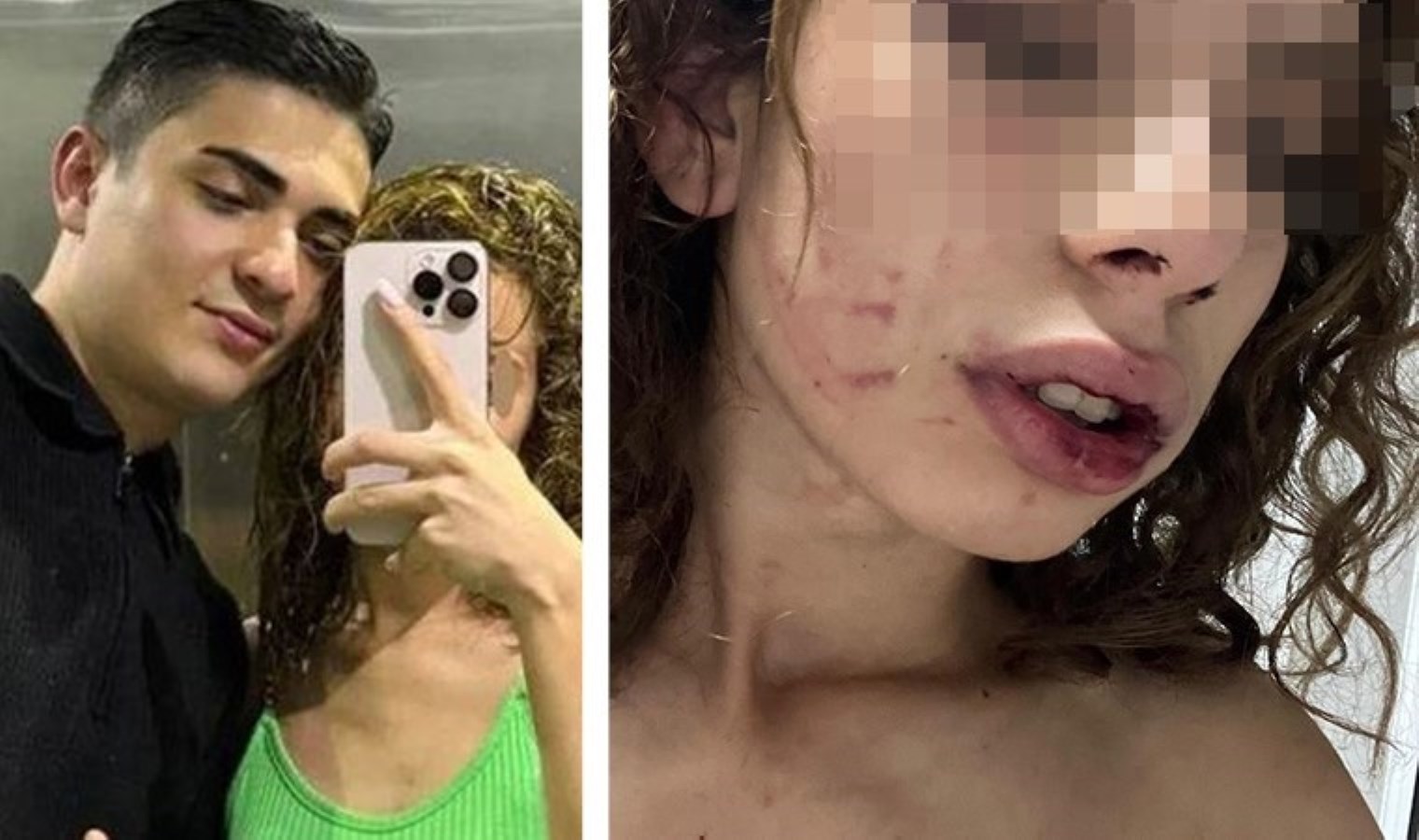 Konya’da erkek vahşeti! Kendisinden ayrılmak isteyen kadına saatlerce işkence yaptı: Adli kontrolle serbest kaldı!