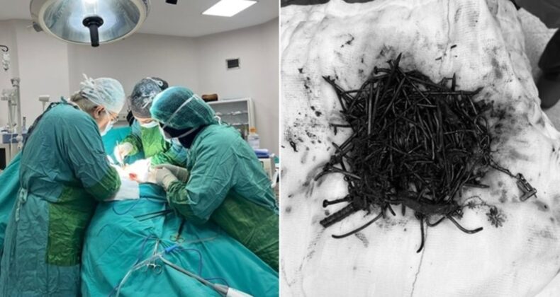 Doktorlar bile şaşırdı: Midesinden 1 kilo metal cisim çıktı!