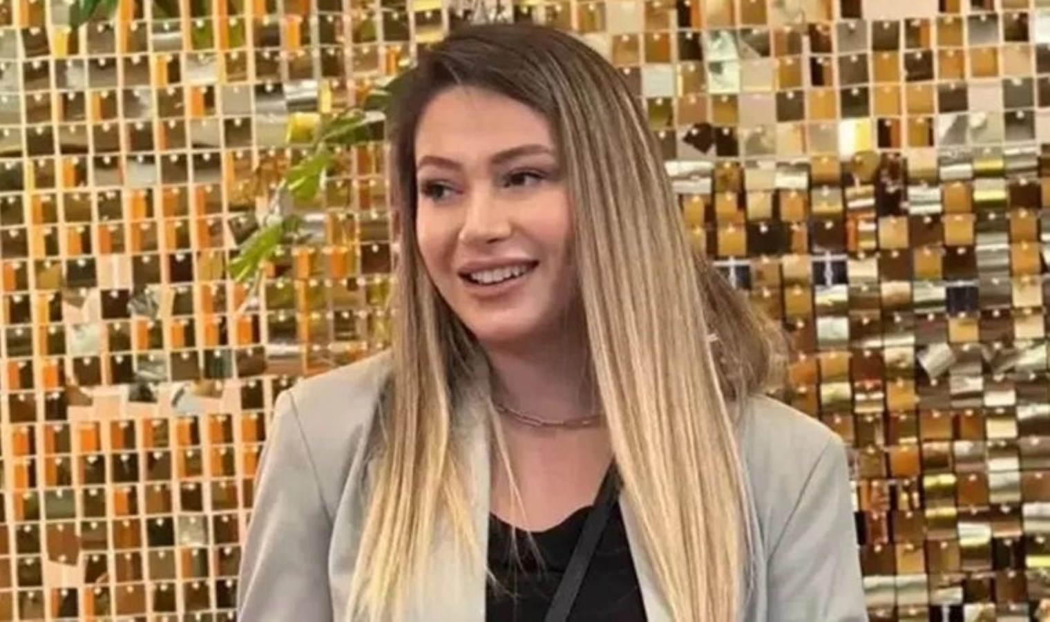 Fenomen Neşe Özkan hayatını kaybetmişti: Uzmanlardan ‘estetik’ uyarısı geldi