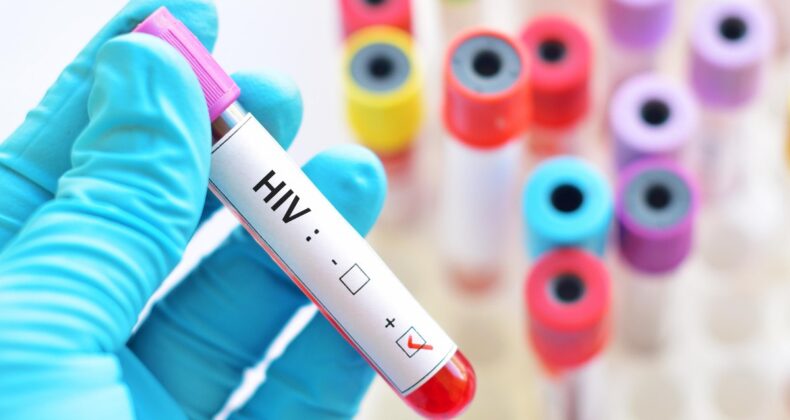 HIV enfeksiyonlarını neredeyse yüzde 100 önleyebilen bir ilaç bulundu