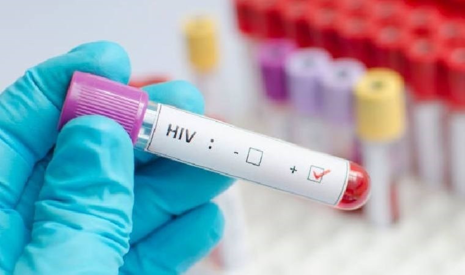 HIV pozitif olduğunu eşinden saklayan erkek hakkında istenen ceza belli oldu!