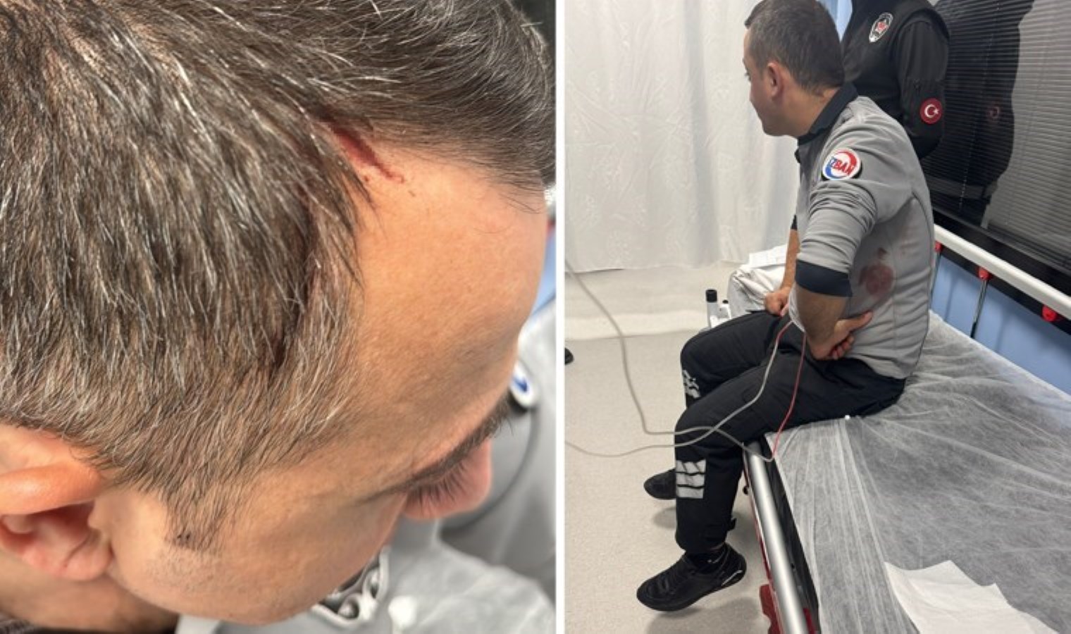 İZBAN’da panik anları: ‘Sigara’ kavgasında 2 güvenlik görevlisi bıçaklandı