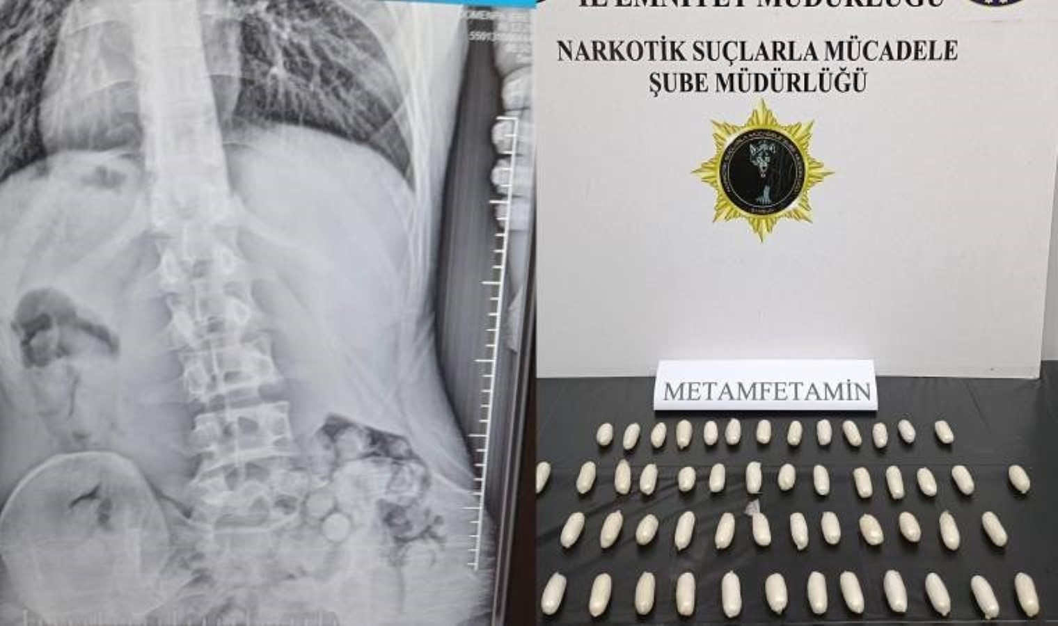 Samsun’da yakalandı: Midesinden 309 gram uyuşturucu çıktı!