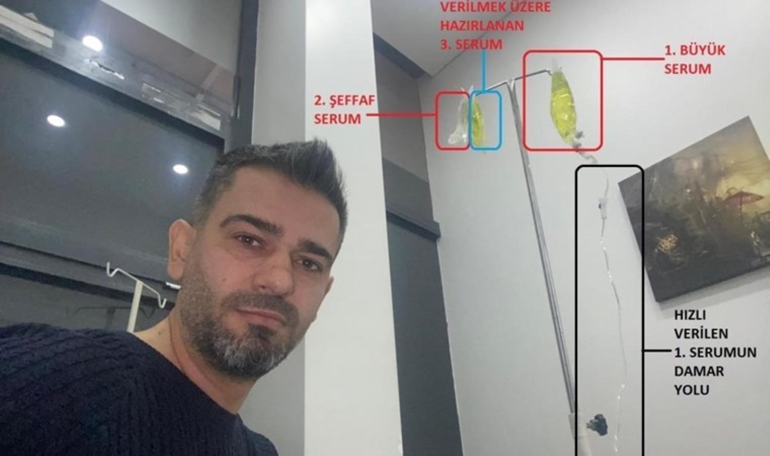 Afyonkarahisar’da ‘sarı serum’ faciası: Hastanede hayatını kaybetti!