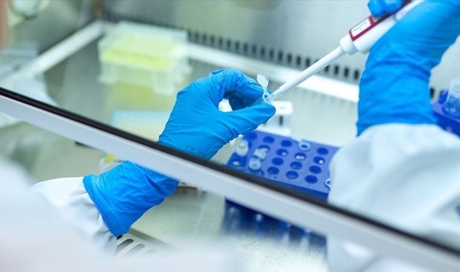 Araştırma: Kadınların kansere yakalanma olasılığı, erkeklerden iki kat daha fazla