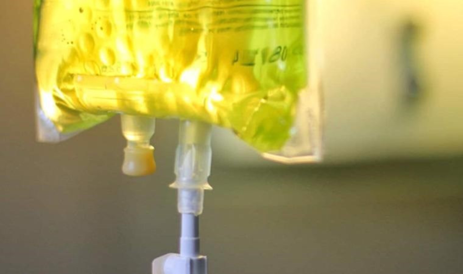 Bağışıklığımı güçlendireyim derken canınızdan olmayın! ‘Sarı Serum’ a dikkat!